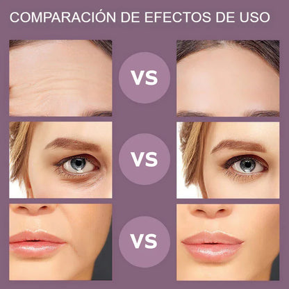 SKINGLOW™- REJUVENECE TU ROSTRO CON MICROCORRIENTES