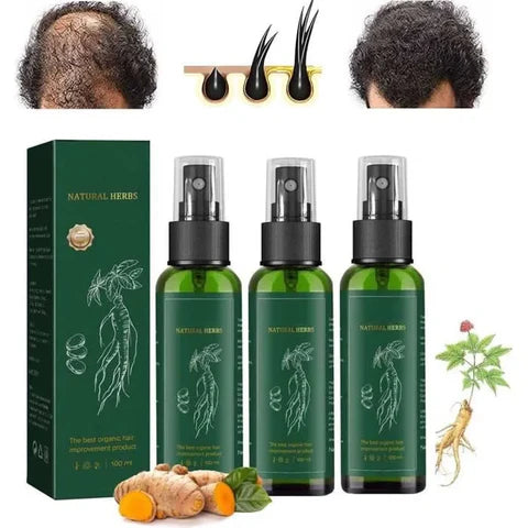 OUHOE™- Spray para el crecimiento del cabello